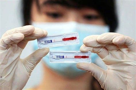 Health official admits: Cebu City HIV cases alarming.